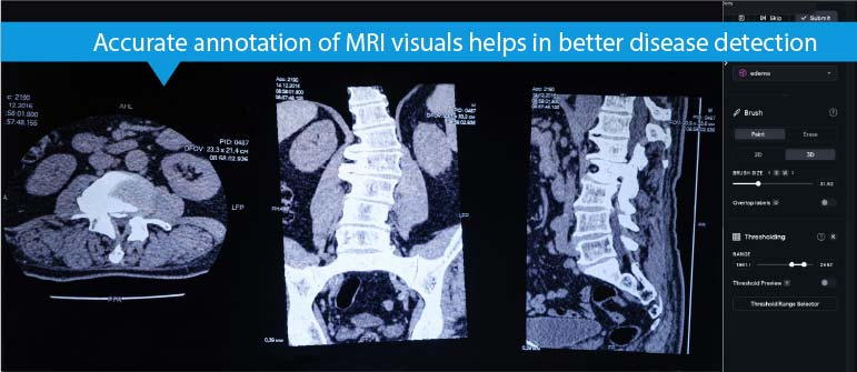 annotation of MRI visuals